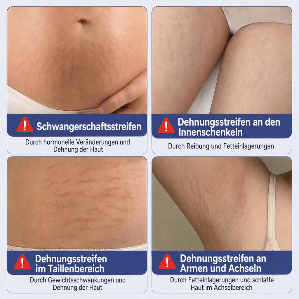 Trockenöl Roll-On 50 ml, pflegendes Körperöl ohne fettiges Hautgefühl, für Haut mit Dehnungsstreifen, auch für empfindliche Haut, hergestellt in Frankreich