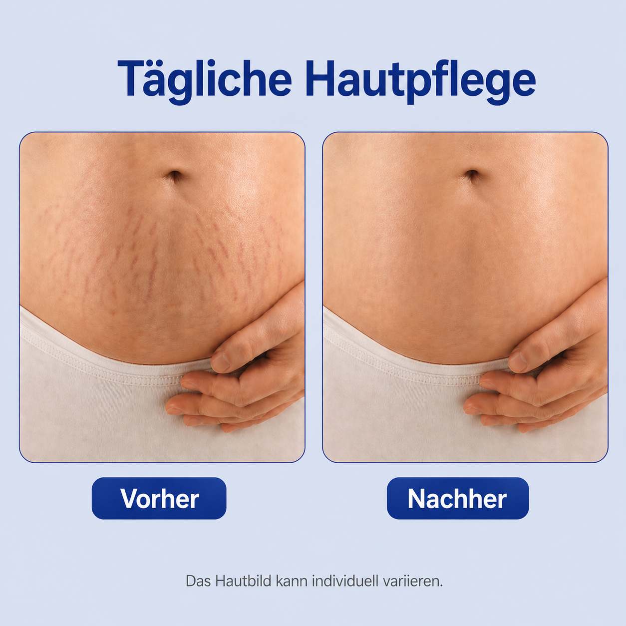 Trockenöl Roll-On 50 ml, pflegendes Körperöl ohne fettiges Hautgefühl, für Haut mit Dehnungsstreifen, auch für empfindliche Haut, hergestellt in Frankreich